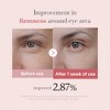 PDRN PINK PEPTIDE EYE SERUM 30ml