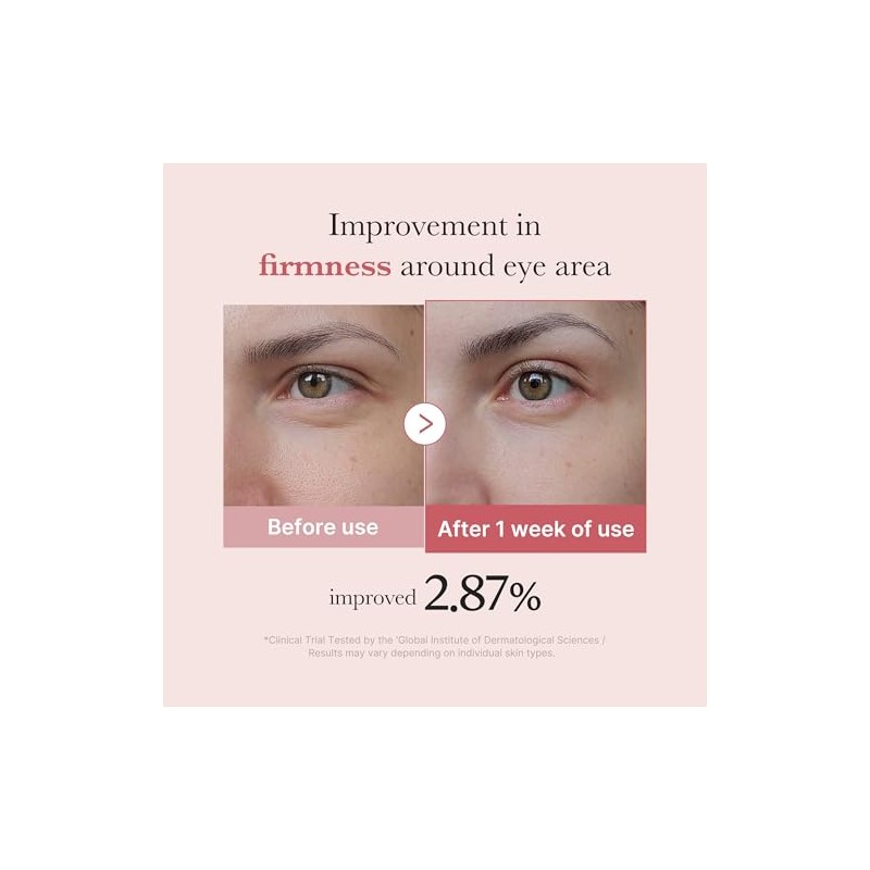 PDRN PINK PEPTIDE EYE SERUM 30ml