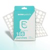 108 Parches para Acné con Hidrocoloide – Everglow Skin Solutions