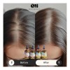 Aceite Cúrcuma Natural Para Cabello Sano Y Cuero Cabelludo 1