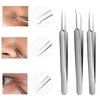 WSYUB Blackhead Tweezers, Blackhead Extractor, Pimple Popper Tool Kit, 3