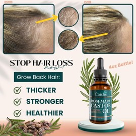 Live Fraiche Rosemary Castor Oil for Hair Growth 4 Ounce - Cold Pressed Castor Oil and Rosemary Oil for Damaged Hair to Reduce Hair Loss
