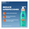NIVEA Derma Skin Clear Gel Limpiador Anti-imperfecciones (150 ml), con