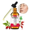 Aceite De Rosa Mosqueta Puro Hidratante Facial Y Capilar
