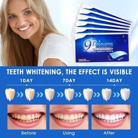 nailpretty 28 Strips Bleaching Stripes, Zahnaufhellung Bleaching Ohne Schmerzempfindlichkeit, Effektive Fleckentfernung Einfache Zahnaufhellung zu Hause