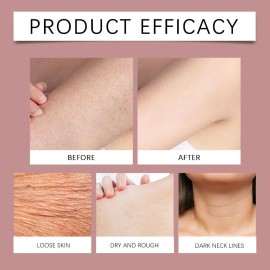 Gentle Care Nourishing Hand And Foot Cream*1