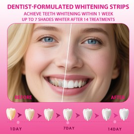 Pack of 28 Teeth Whitening Strips - Professional Teeth Whitening Strips, Whitening Teeth for Whiter Teeth - Quick Whitening, Removes Discolouration & Stains, with Fresh Mint Flavour (Pink)