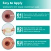 Ostomy Barrier Rings - Outer Diameter 2" (50mm) 4mm Thickness,Moldable