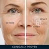 Roc Retinol Correxion Anti Aging Eye Cream Treatment Packaging May