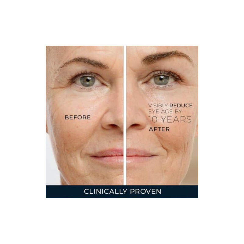 Roc Retinol Correxion Anti Aging Eye Cream Treatment Packaging May