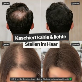 IMPERIO IMPERIO Streuhaar zur Haarverdichtung & vollem Haar in Sekunden. Schtthaar fr einen authentischen Look. 100% Natur! In Premium Friseurqualit?t - 26g (Dunkelbraun)