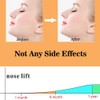 AMIJEAL Nose Shaper Clip - Up Lifting Clip, Pain-Free Soft
