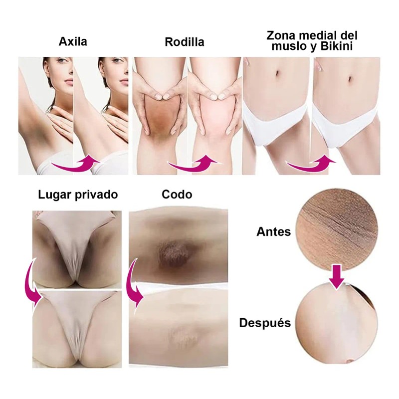Crema Blanqueadora Para Zonas Privadas Efectiva