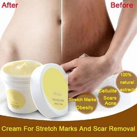 POPETPOP 3piezas Crema Reparadora De Estrías y Cicatrices Para Embarazo Loción Hidratante y Reafirmante Para Mamás Postparto De Pasjel Hecha Ingredientes Naturales
