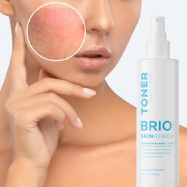 BRIOTECH Hypochlorous Acid Spray Toner Face and Skin, BrioCare Skin Renew Toner Topical Skin Spray, HOCl Skincare, Minimize Appearance of Acne, Soothing Mist for Redness & Bumps