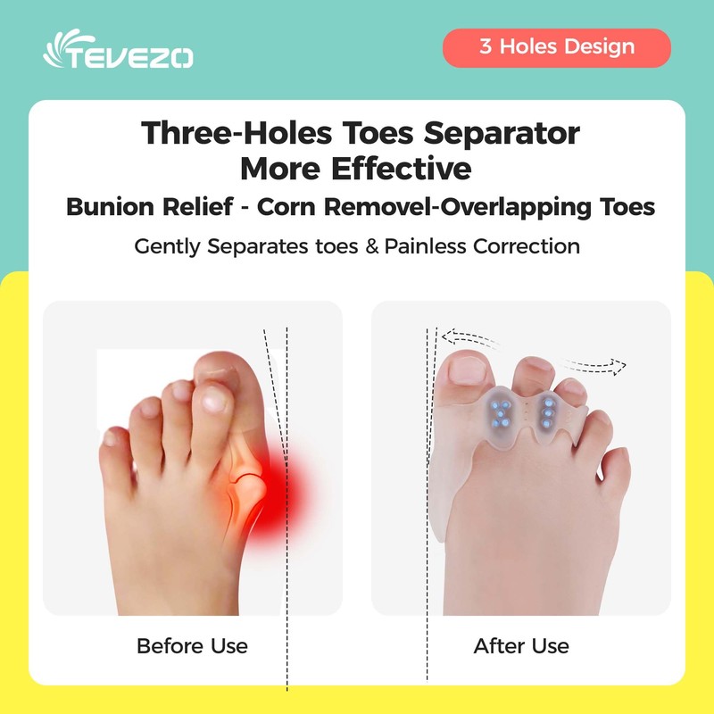 TEVEZO Toe Spacers & Bunion Corrector for Kids | Toe