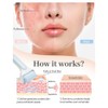 Peakloong Ice Roller for Puffiness Relief and Dark Circles, Face