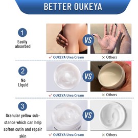 OUKEYA Crema de Urea 40% con Glicerina y Vitamina E 150g Urea 40%, Glicerina, Vitamina E, Hidratación Corporal, Cuidado de Pies, Talones y Manos, Uso Diario