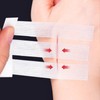 Pack of 65 Staple Plasters Wound Seam Strips for Wounds