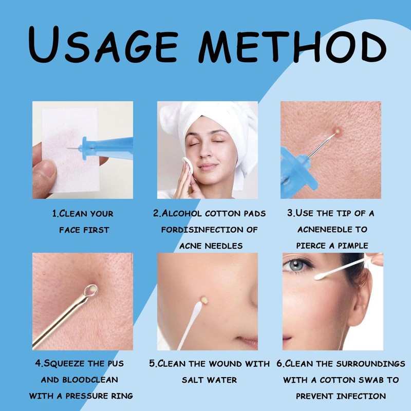 200 Pcs Pimple Needle Blackhead Blemish Remover,Milia Removal Needle Blue