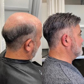 blazingfire Toupee for Men Hair Replcement System Mens Toupee Human Hair Piece Full Poly Thin Skin All PU Injection Male Toupee 8x10 Inch 1B Off Black with 60% Synthetic Grey Hair