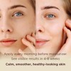 MATKAS Korean Hydrating Antioxidant Centella Face Serum for Pores 1