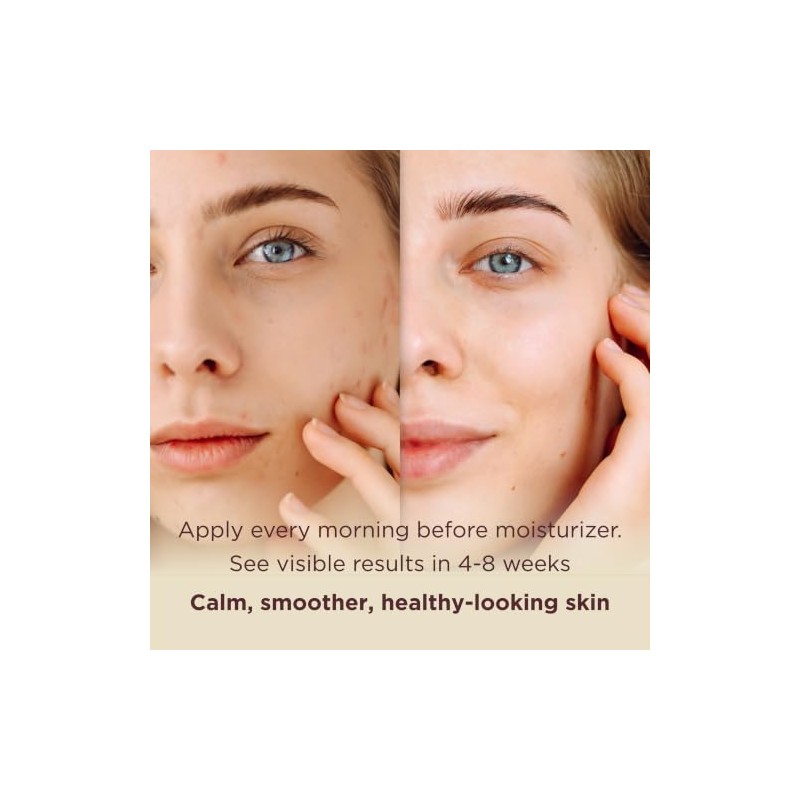 MATKAS Korean Hydrating Antioxidant Centella Face Serum for Pores 1