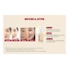 Ksecret Seoul 1988 Serum Retinal Liposome 2% + Black Ginseng