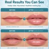 BP Spicule Lip Plumper Gloss, Vitamin E Hydrating Plumping Shot