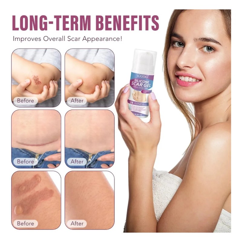 Scar Gel Vogsig Reparador Piel Reducción De Marcas Hidrata Mixta