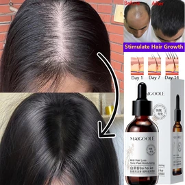 No Brand hair tonic hair growth serum 60ml Quick Hair Growth anti hair loss oil control repair fragile For both men and women