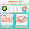 Ingrown Toenail Tool Set, Corrector Pedicure, Ingrown Toenails Set, 30