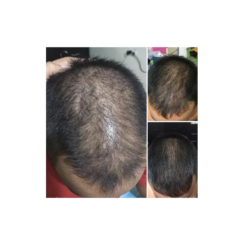 Locion Al 7 Crecimiento Cabello Fortificado 60ml 6 Meses
