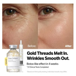 Martiderm Acniover Serum Momento de aplicación Día/Noche Tipo de piel Todo tipo de piel