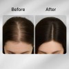 Ampolla Para Cabello Reedle Shot De Pdrn, 15 Ml, Para