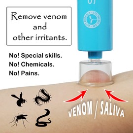 Richbond Piston Stiffness Improved Bug Bite Suction Tool Suction-DX Insect Poison Remover Strong Suction Power Japan Designed Tool Mosquito Snake Scorpion wasp Bedbug