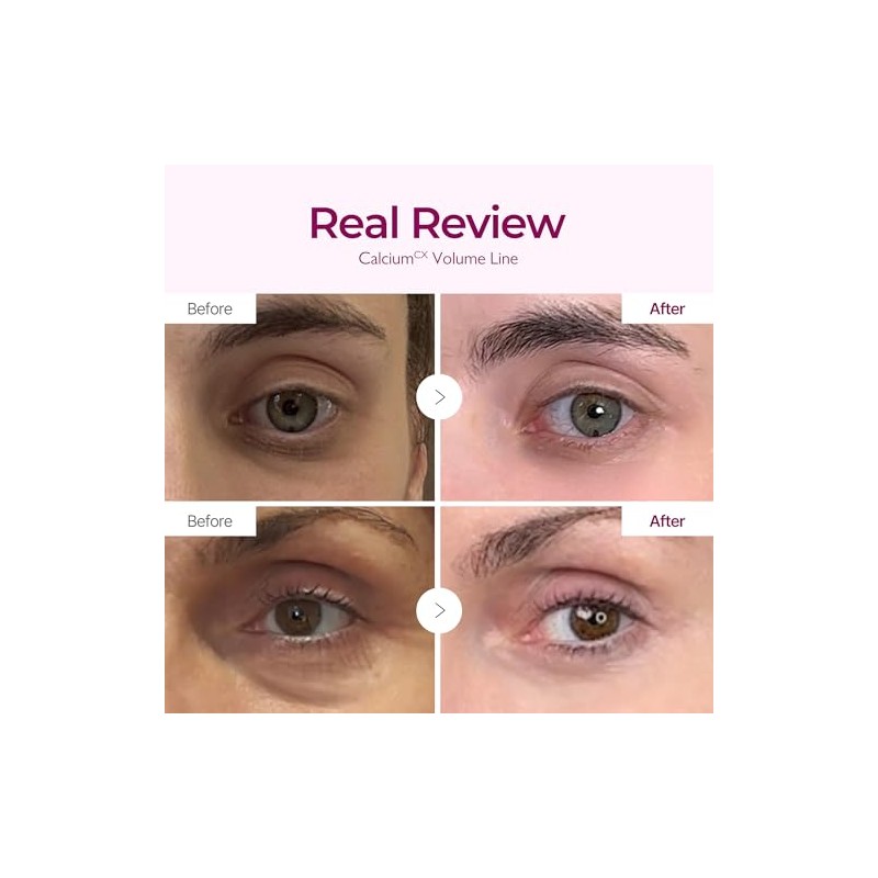 Dr.Melaxin CEMENRETE EYE CREAM