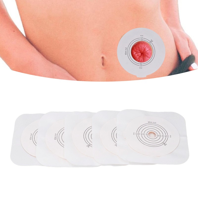 5Pcs Ostomy Barrier Ring Leakage Proof Versatile Ostomy Barrier Extender