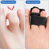 2 Stück Hammerzehen Korrektur, Hammerzehen Korrektoren, Hammerzeh Korrektur, Krallenzehen Korrektur,
