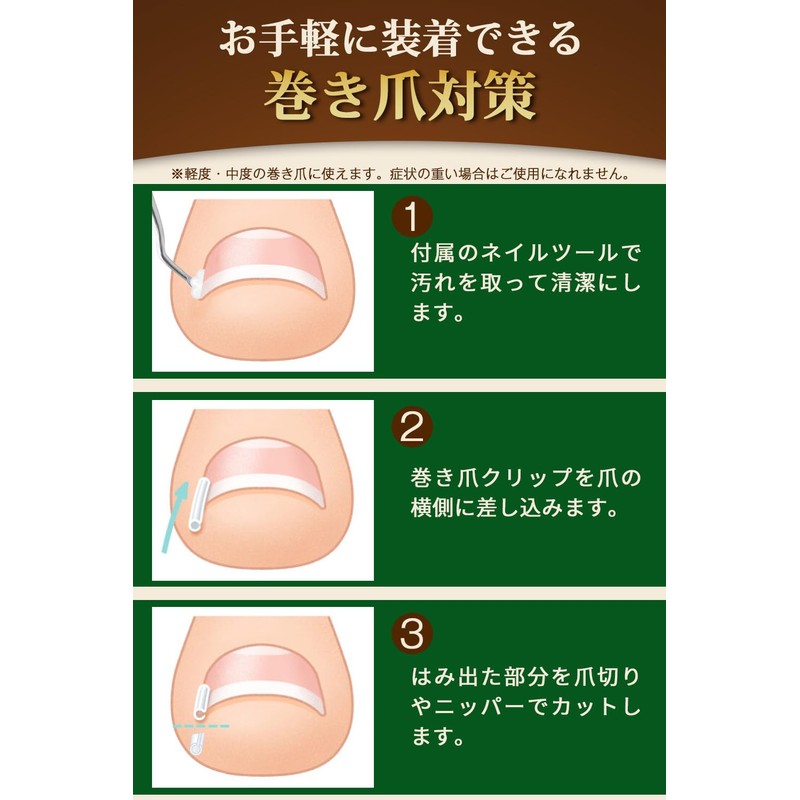 Ale Nail Clip 10 Pieces + Nail Tool Set