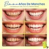 Tiras Blanqueadoras Dentales 7 Pares, Blanqueamiento Efectivo, Dientes Blancos, Antideslizantes,