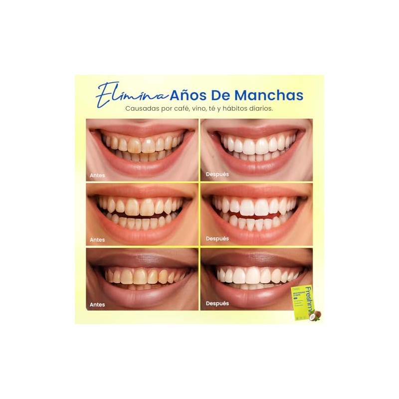 Tiras Blanqueadoras Dentales 7 Pares, Blanqueamiento Efectivo, Dientes Blancos, Antideslizantes,