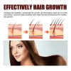 Champú X Hair Growth, Champú Para Engrosar El Cabello, Anti-