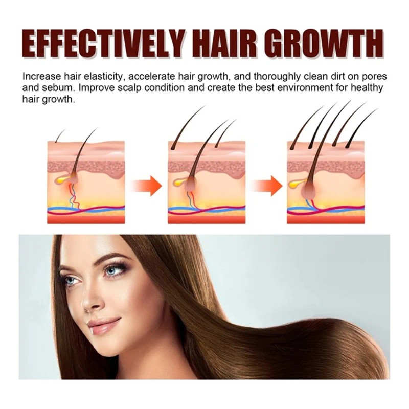 Champú X Hair Growth, Champú Para Engrosar El Cabello, Anti-
