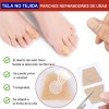 & [100 Parches Antimicóticos Para El Tratamiento De Hongos E