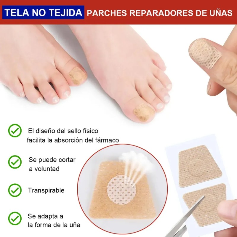 & [100 Parches Antimicóticos Para El Tratamiento De Hongos E