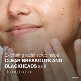 Limpiador facial de Neutrogena para el acné sin aceite, Rosado