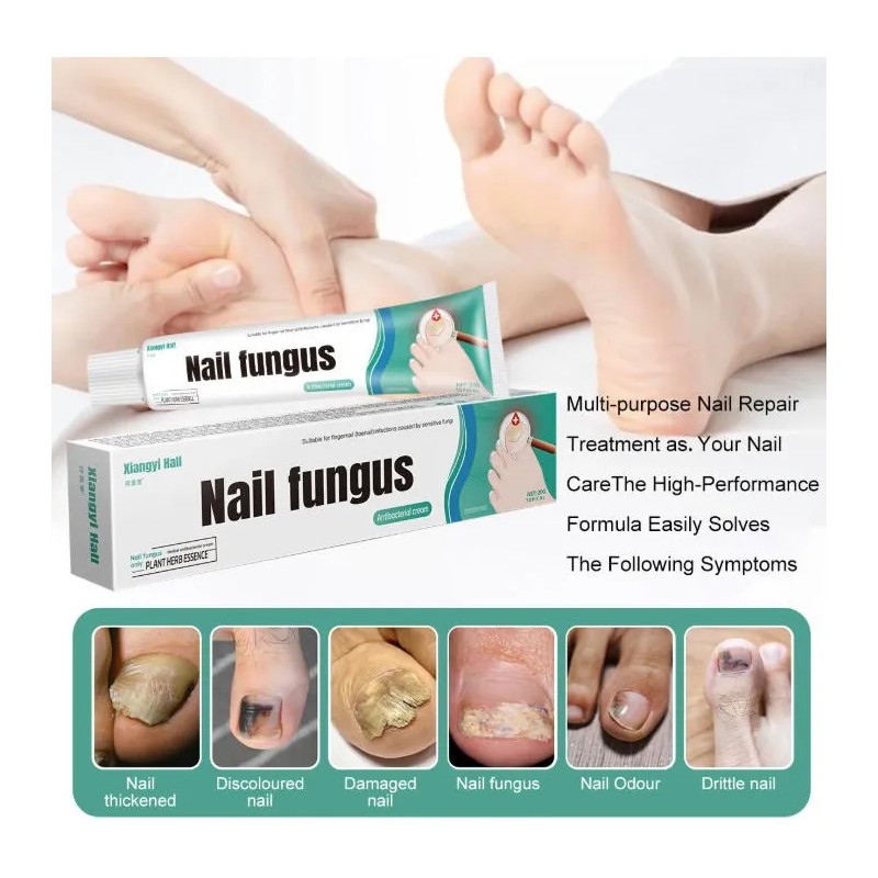 Ungüento Para Hongos En Las Uñas Tratamiento Efectivo 20g