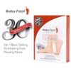 Baby Foot Exfoliation Foot Peel, Exfoliación Para Los Pies, Lavanda