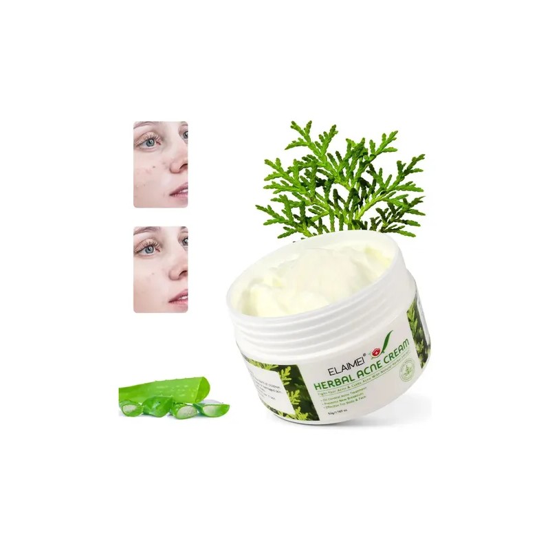Crema Facial Elaimei Para El Cuidado Del Acné (50g)